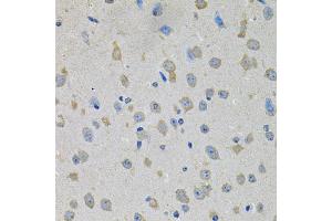 Immunohistochemistry of paraffin-embedded mouse brain using PTK7 antibody. (PTK7 Antikörper)