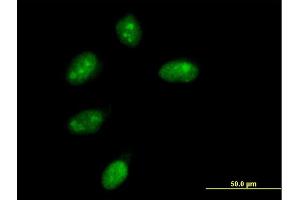 Immunofluorescence of purified MaxPab antibody to NMNAT1 on HeLa cell. (NMNAT1 Antikörper  (AA 1-279))