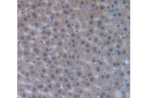 IHC-P analysis of Rat Tissue, with DAB staining. (Chemerin Antikörper  (AA 25-152))