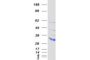 Validation with Western Blot (LDLRAD2 Protein (Myc-DYKDDDDK Tag))