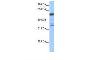 Image no. 1 for anti-Coilin (COIL) (AA 460-509) antibody (ABIN6738870) (Coilin Antikörper  (AA 460-509))