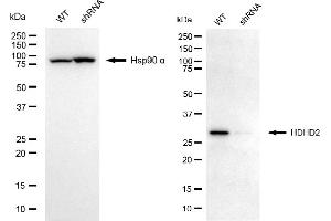 Western blotting analysis using HDHD2 antibody (ABIN7798834). (HDHD2 Antikörper)