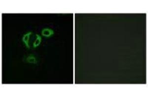 Immunofluorescence analysis of A549cells, using TACC3 antibody. (TACC3 Antikörper  (C-Term))