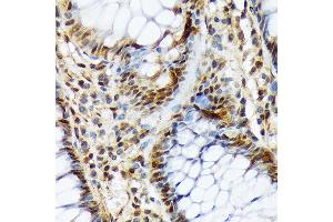 Immunohistochemistry of paraffin-embedded human colon using COPS3 Rabbit mAb (ABIN7266498) at dilution of 1:100 (40x lens). (COPS3 Antikörper)