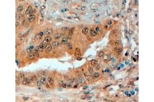 ABIN334487 (4µg/ml) staining of paraffin embedded Human Prostate. (SEMA3E Antikörper  (Internal Region))