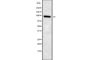 Western blot analysis of ADAM23 using Jurkat whole cell lysates (Adam23 Antikörper  (C-Term))
