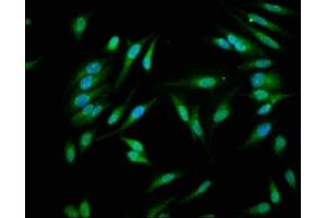 Immunofluorescence staining of Hela cells with ABIN7146926 at 1:266, counter-stained with DAPI. (Caspase 1 Antikörper  (AA 120-269))