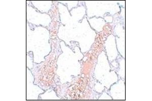 Immunohistochemistry of REEP2 in rat lung tissue with this product at 5 μg/ml. (REEP2 Antikörper  (Center))