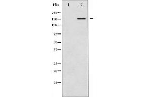Western blot analysis of Bcr expression in K562 whole cell lysates,The lane on the left is treated with the antigen-specific peptide. (BCR Antikörper  (N-Term))