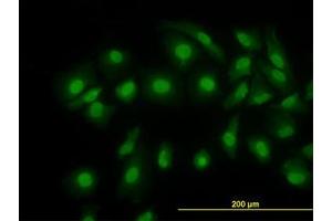 Image no. 1 for anti-Cofilin 1 (CFL1) (AA 1-167) antibody (ABIN598606) (Cofilin Antikörper  (AA 1-167))