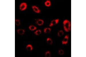 Immunofluorescent analysis of GILZ staining in U2OS cells. (TSC22D3 Antikörper)