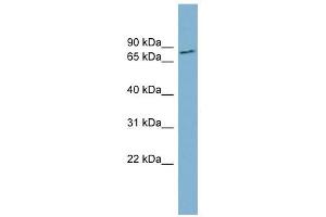 FURIN antibody used at 1 ug/ml to detect target protein. (FURIN Antikörper)