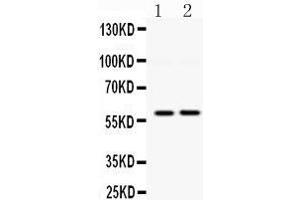 Observed bind size: 60KD (DGAT1 Antikörper  (Middle Region))