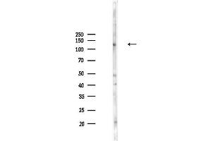anti-DAB2 Interacting Protein (DAB2IP) (C-Term) antibody