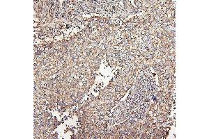 IHC analysis of MVP using anti-MVP antibody (ABIN7600481).