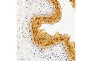 Immunohistochemistry of paraffin embedded mouse esophagus using SPRR3 (ABIN7075637) at dilution of 1:2000 (300x lens) (SPRR3 Antikörper)