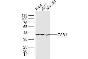 Human Hela, 293T, and Mb-231 cells probed with ZAR1 Polyclonal Antibody, unconjugated  at 1:300 overnight at 4°C followed by a conjugated secondary antibody at 1:10000 for 90 minutes at 37°C. (Zygote Arrest 1 Antikörper  (AA 351-424))