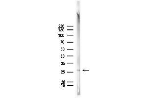 Western blot analysis of lysates from Mouse lung, using Rabl2 Antibody at 1/1000 dilution. (Rabl2 Antikörper  (C-Term))