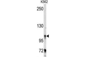 Western Blotting (WB) image for anti-Bicaudal D Homolog 2 (BICD2) antibody (ABIN3003477) (BICD2 Antikörper)