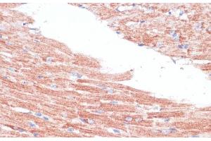Immunohistochemistry of paraffin-embedded Mouse heart using FZD4 Polyclonal Antibody at dilution of 1:100 (40x lens). (FZD4 Antikörper)