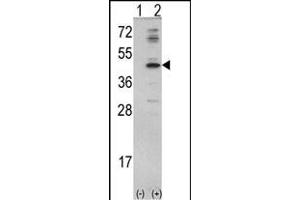 Western blot analysis of MVD (arrow) using rabbit polyclonal MVD Antibody (N-term) (ABIN390673 and ABIN2840969). (MVD Antikörper  (N-Term))