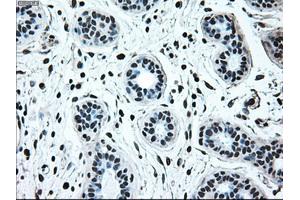 Immunohistochemical staining of paraffin-embedded breast tissue using anti-IRF3 mouse monoclonal antibody.