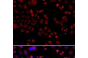 Immunofluorescence analysis of A549 cells using SLC22A11 Polyclonal Antibody (SLC22A11 Antikörper)