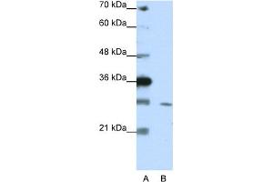 WB Suggested Anti-ZNF397 Antibody Titration:  1. (ZNF397 Antikörper  (C-Term))