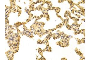 Immunohistochemistry of paraffin-embedded rat lung using PPP4C antibody. (PPP4C Antikörper  (AA 1-307))