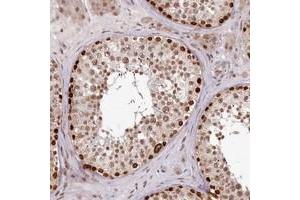 Immunohistochemical staining of human testis with THYN1 polyclonal antibody  shows strong nuclear positivity in subsets of cells in seminiferus ducts at 1:200-1:500 dilution.