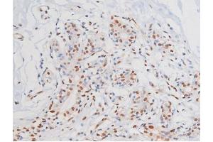 ABIN6267364 at 1/200 staining Human heart tissue sections by IHC-P. (KIT Antikörper  (pTyr703))