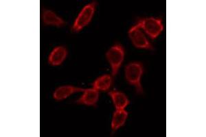 ABIN6266979 staining HeLa by IF/ICC. (GK2 Antikörper  (Internal Region))
