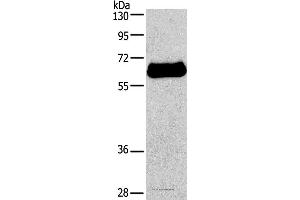 Western blot analysis of HepG2 cell, using IL2RB Polyclonal Antibody at dilution of 1:650 (IL2 Receptor beta Antikörper)