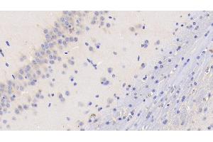 Immunohistochemistry (IHC) image for anti-Coagulation Factor III (thromboplastin, Tissue Factor) (F3) (AA 30-251) antibody (ABIN7427675)