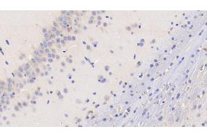 Detection of TF in Mouse Cerebellum Tissue using Monoclonal Antibody to Tissue Factor (TF)