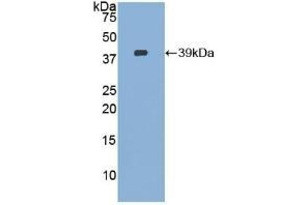 Ezrin anticorps  (AA 1-295)