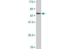 Western Blot detection against Immunogen (73. (ENO1 Antikörper  (AA 1-434))