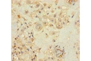 Immunohistochemistry of paraffin-embedded human placenta tissue using ABIN7142685 at dilution of 1:100 (PRKRIR Antikörper  (AA 612-761))