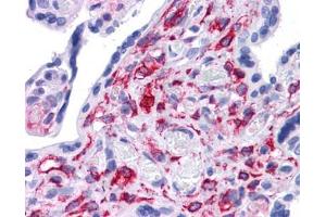 Stat5b antibody was used for immunohistochemistry at a concentration of 4-8 ug/ml. (STAT5B Antikörper  (C-Term))