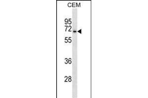 ACCN3 Antibody (N-term) (ABIN1539468 and ABIN2838152) western blot analysis in CEM cell line lysates (35 μg/lane). (ASIC3 Antikörper  (N-Term))