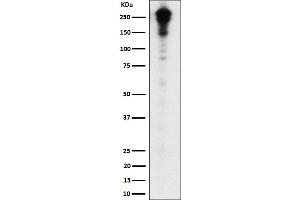 Western blot analysis of Desmoplakin expression in A431 cell lysate.