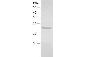 Western Blotting (WB) image for KDEL (Lys-Asp-Glu-Leu) Containing 1 (KDELC1) (AA 326-494) protein (His tag) (ABIN7123667) (KDELC1 Protein (AA 326-494) (His tag))