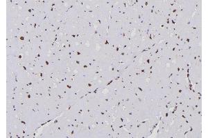 ABIN6259987 and ABIN6276683 at 1/100 staining Human heart tissue by IHC-P.