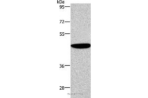Western blot analysis of Human fetal brain tissue, using ABI1 Polyclonal Antibody at dilution of 1:300 (ABI1 Antikörper)