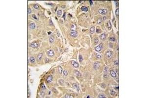 Immunohistochemistry (Paraffin-embedded Sections) (IHC (p)) image for anti-Protein tyrosine Phosphatase, Non-Receptor Type 7 (PTPN7) (Ser44) antibody (ABIN359780)