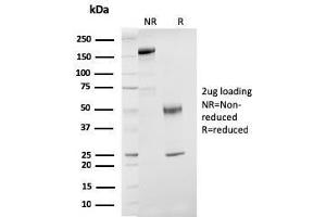 SDS-PAGE Analysis Purified ER-beta Mouse Monoclonal Antibody (ESR2/3207). (ESR2 Antikörper)