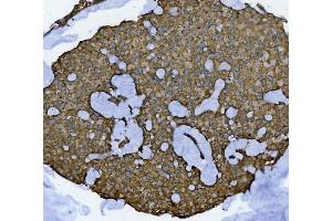 IHC analysis of GLB1/Beta-galactosidase using anti-GLB1/Beta-galactosidase antibody (ABIN7601806). (GLB1 Antikörper  (AA 46-655))