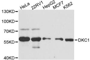 Western blot analysis of extracts of various cell lines, using DKC1 antibody. (DKC1 Antikörper)