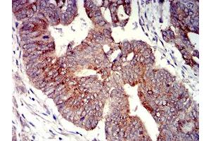 Immunohistochemistry (IHC) image for anti-Pyrimidinergic Receptor P2Y, G-Protein Coupled, 4 (P2RY4) antibody (ABIN5611350)