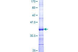 STARD5 Protein (AA 121-212) (GST tag)